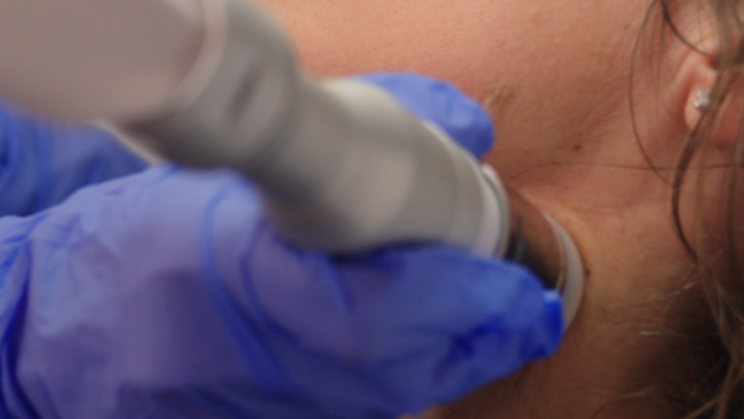 Dott.ssa Crisciotti - Medico di medicina estetica - radiofrequenza medicale