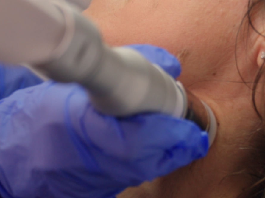 Dott.ssa Crisciotti - Medico di medicina estetica - radiofrequenza medicale
