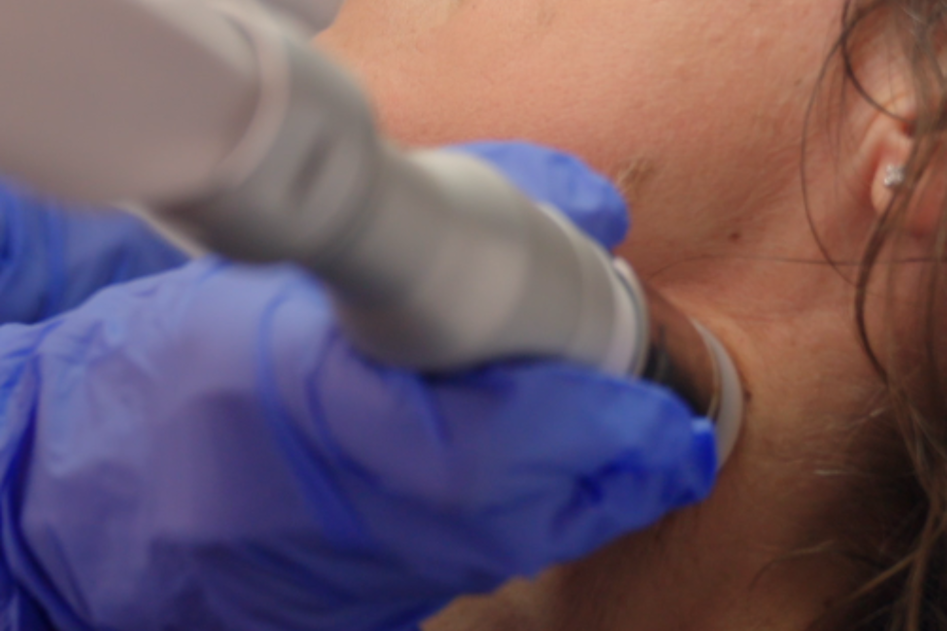 Dott.ssa Crisciotti - Medico di medicina estetica - radiofrequenza medicale