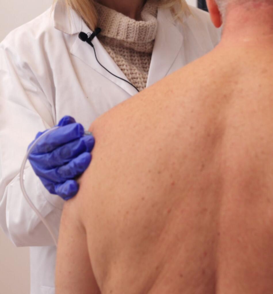 Carbossiterapia trattamento infiammazione - Dott.ssa Flaminia Crisciotti Medicina Estetica e Medico Geriatra