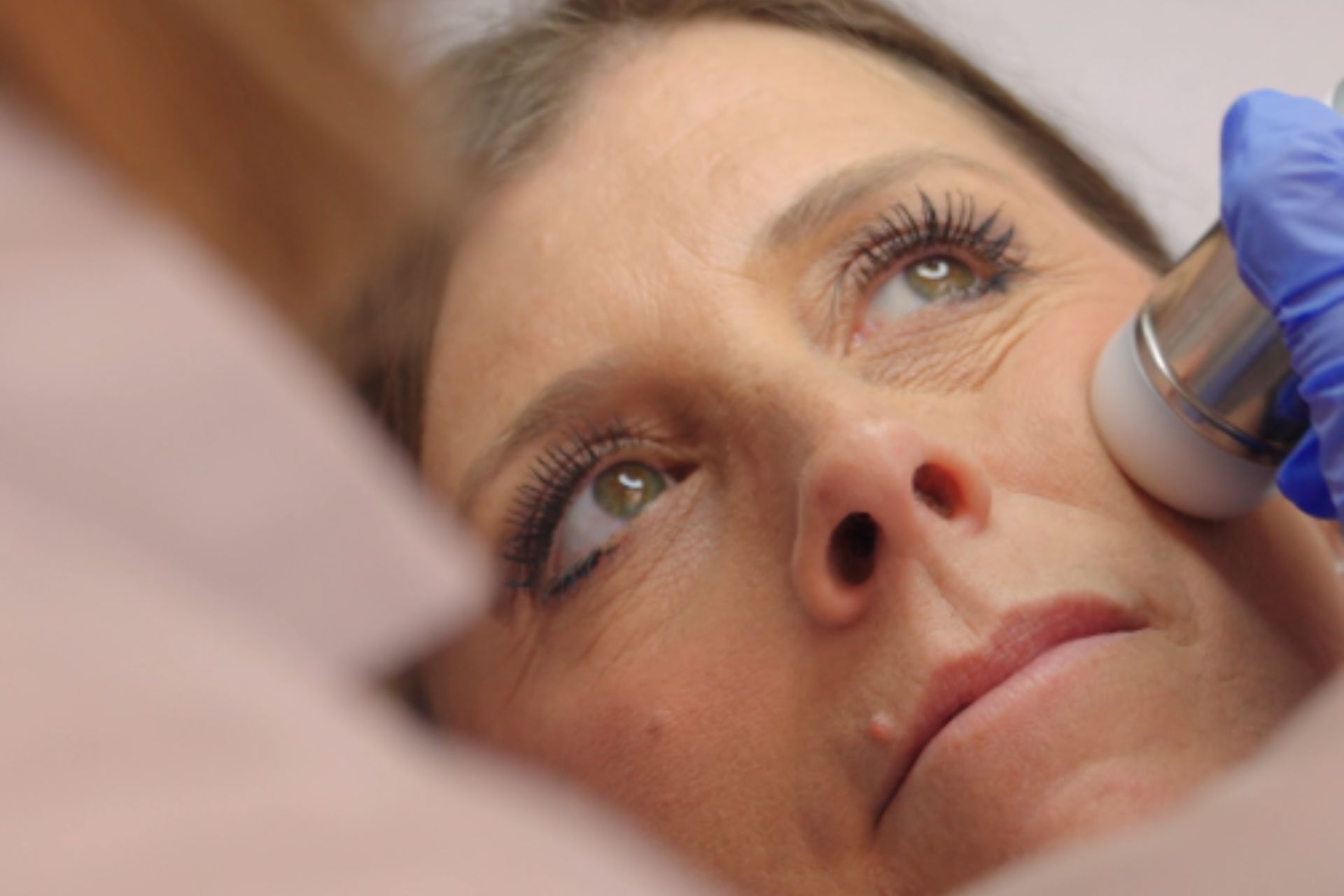 Radiofrequenza viso donna - Medicina Estetica - Dott.ssa Flaminia Crisciotti Medico Geriatra e Medicina Estetica