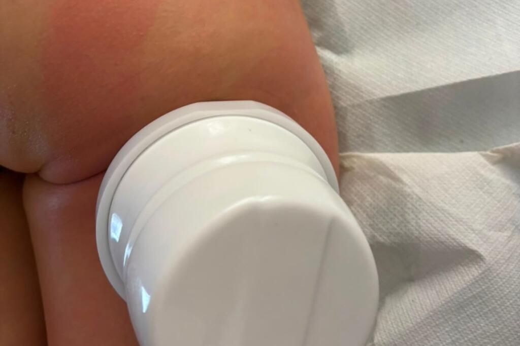 radiofrequenza corpo per cellulite duoshape - Dott.ssa Flaminia Crisciotti Medico Geriatra e Medicina Estetica